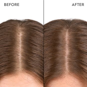 KERASILK Specialists Moisturizing Scalp Drops picături pentru scalp sensibil si uscat - imagine 3